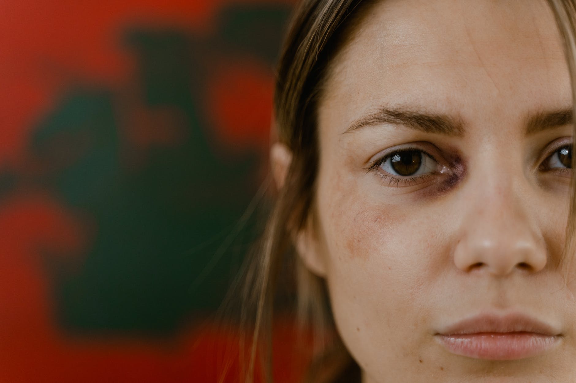 a close up shot of a woman with black eye